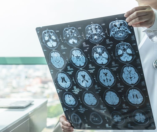 Early Inpatient Palliative Care Consultation Is Associated With Shorter Hospital Stays For Elderly Patients With TBI.