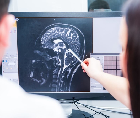 4 Common Causes of Traumatic Brain Injuries in Los Angeles
